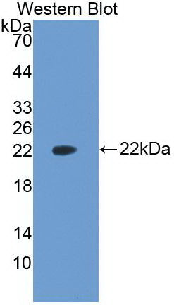 Monoclonal Antibody to Vascular Endothelial Growth Factor A (VEGFA)