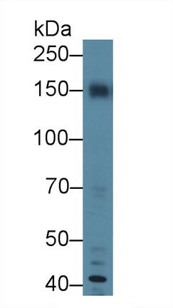 Monoclonal Antibody to Carbohydrate Antigen 19-9 (CA19-9)