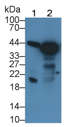 Monoclonal Antibody to Pepsinogen A (PGA)