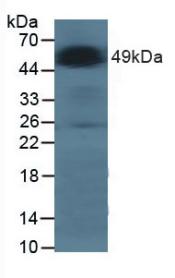 Monoclonal Antibody to Galactosidase Alpha (GLa)