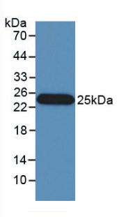 Monoclonal Antibody to Interferon Beta (IFNb)