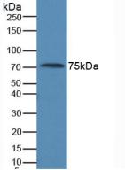 Monoclonal Antibody to Anti-Mullerian Hormone (AMH)