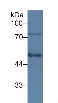 Monoclonal Antibody to Complement 1 Inhibitor (C1INH)