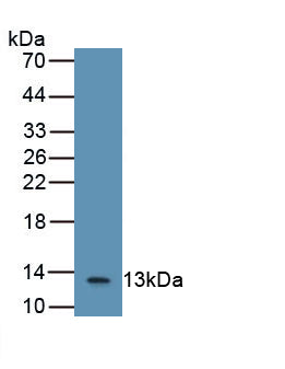 Monoclonal Antibody to Beta-2-Microglobulin (b2M)