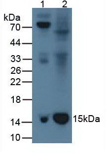 Monoclonal Antibody to Beta-2-Microglobulin (b2M)