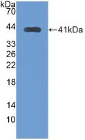 Monoclonal Antibody to Transferrin Receptor 2 (TFR2)