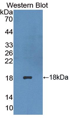 Monoclonal Antibody to Platelet/Endothelial Cell Adhesion Molecule (PECAM1)