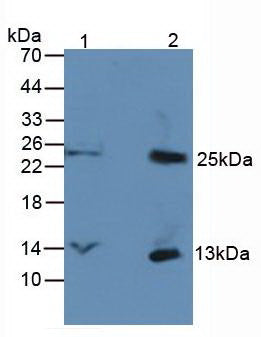 Monoclonal Antibody to Chemokine (C-X-C motif) ligand 7 ( CXCL7)