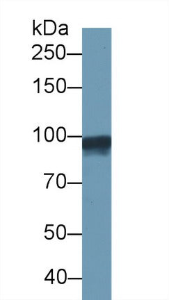 Monoclonal Antibody to Gelsolin (GSN)