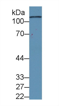 Monoclonal Antibody to Complement Component 5a (C5a)