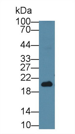 Monoclonal Antibody to Neurokinin A (NKA)