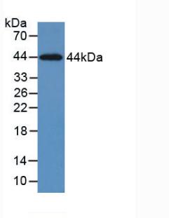 Monoclonal Antibody to Cytokeratin 5 (CK5)