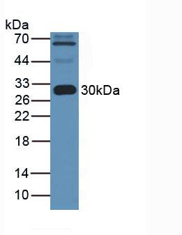 Monoclonal Antibody to Apolipoprotein A1 (APOA1)