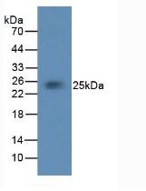 Monoclonal Antibody to Tissue Factor (TF)