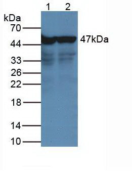 Monoclonal Antibody to Enolase, Neuron Specific (NSE)