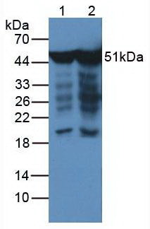 Monoclonal Antibody to Enolase, Neuron Specific (NSE)