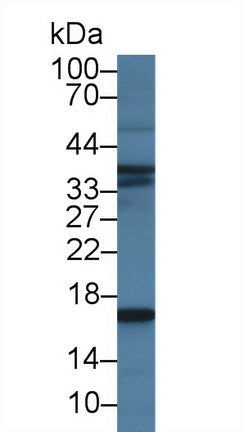 Monoclonal Antibody to Brain Natriuretic Peptide (BNP)