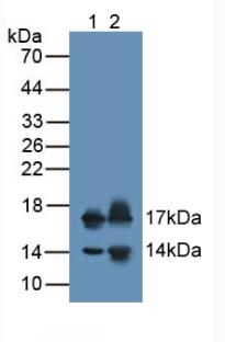 Monoclonal Antibody to Brain Natriuretic Peptide (BNP)