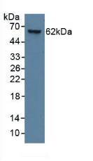 Monoclonal Antibody to Cytokeratin 9 (CK9)