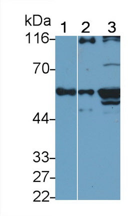 Monoclonal Antibody to Cytokeratin 7 (CK7)