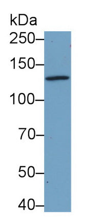 Monoclonal Antibody to Epidermal Growth Factor (EGF)