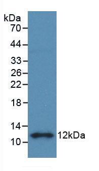 Monoclonal Antibody to S100 Calcium Binding Protein B (S100B)