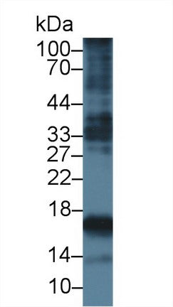 Monoclonal Antibody to Procollagen III N-Terminal Propeptide (PIIINP)