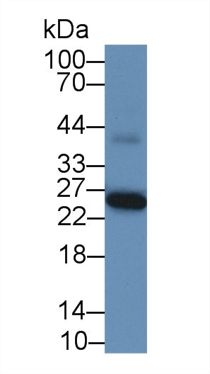 Monoclonal Antibody to Glutathione S Transferase Alpha 1 (GSTa1)