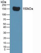 Monoclonal Antibody to Complement Factor H (CFH)