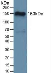 Monoclonal Antibody to Complement Factor H (CFH)