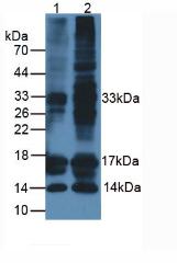 Monoclonal Antibody to Procalcitonin (PCT)