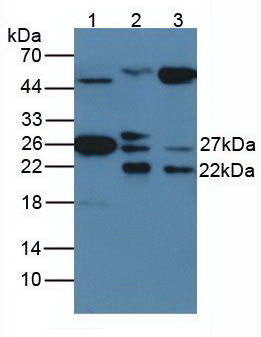 Monoclonal Antibody to Heat Shock Protein 27 (Hsp27)