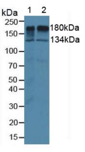 Monoclonal Antibody to Epidermal Growth Factor Receptor (EGFR)