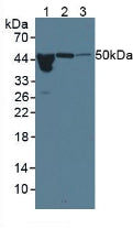 Monoclonal Antibody to Alpha-1-Acid Glycoprotein (a1AGP)