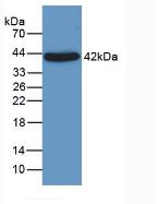 Monoclonal Antibody to Alpha-1-Acid Glycoprotein (a1AGP)
