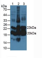 Monoclonal Antibody to Alpha-1-Acid Glycoprotein (a1AGP)