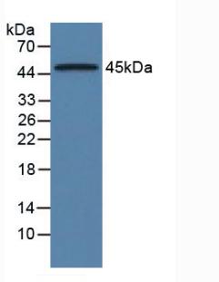 Monoclonal Antibody to Alpha-1-Acid Glycoprotein (a1AGP)