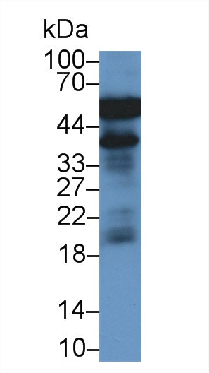 Monoclonal Antibody to Haptoglobin (Hpt)
