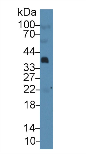 Monoclonal Antibody to Parathyroid Hormone Related Protein (PTHrP)