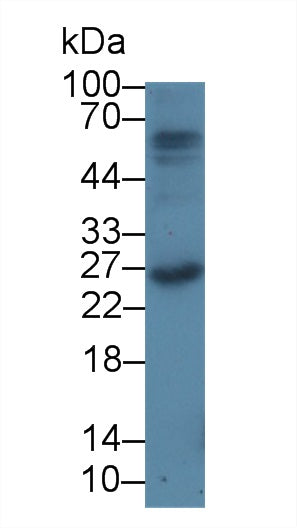 Monoclonal Antibody to Coagulation Factor II (F2)