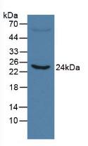 Monoclonal Antibody to C Reactive Protein (CRP)