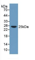 Monoclonal Antibody to C Reactive Protein (CRP)