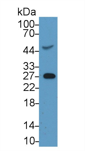 Monoclonal Antibody to C Reactive Protein (CRP)