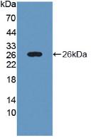 Monoclonal Antibody to Glycogen Phosphorylase, Liver (PYGL)