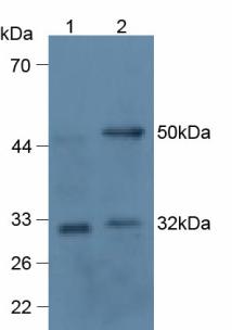 Monoclonal Antibody to Receptor Activator Of Nuclear Factor Kappa B Ligand (RANkL)