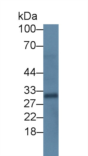 Monoclonal Antibody to Clara Cell Protein 16 (CC16)