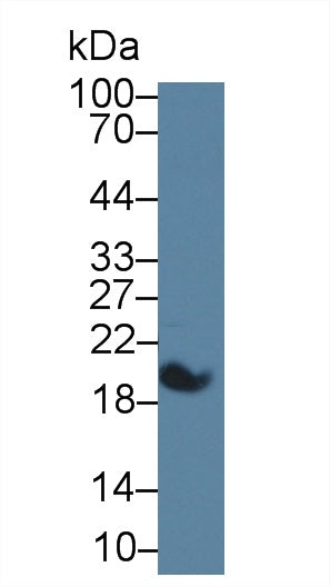 Monoclonal Antibody to Serum Amyloid A (SAA)