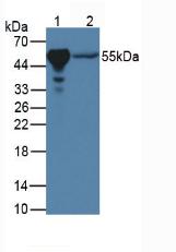 Monoclonal Antibody to Peroxisome Proliferator Activated Receptor Gamma (PPARg)