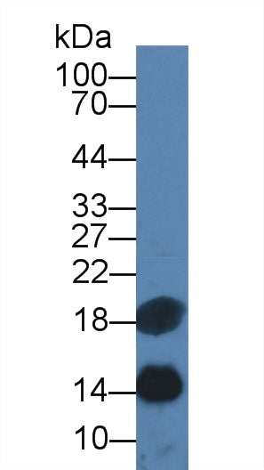 Monoclonal Antibody to Cystatin C (Cys-C)