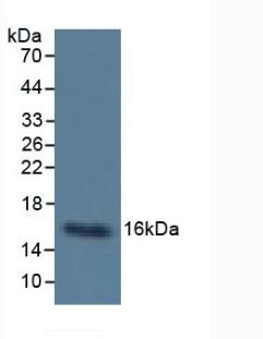 Monoclonal Antibody to Cystatin C (Cys-C)